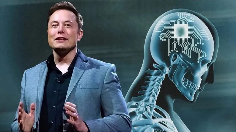 Presentation of Neuralink Elon Musk 2016